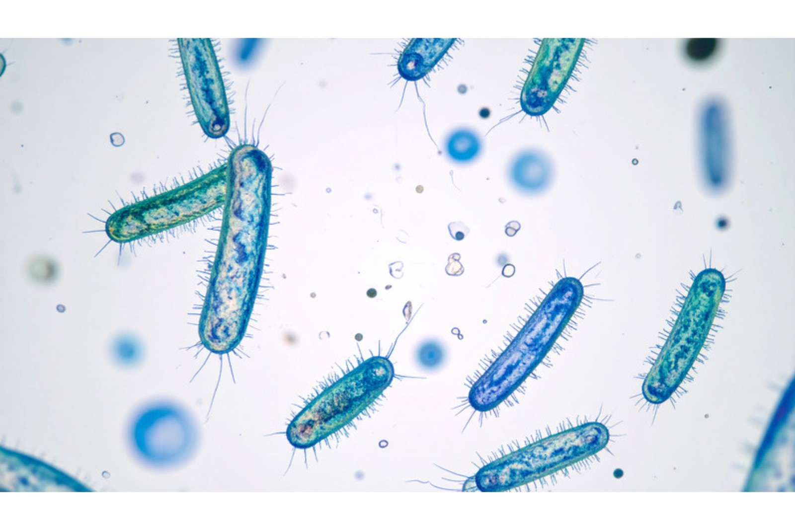 Gut bacteria and blood sugar regulation illustrated